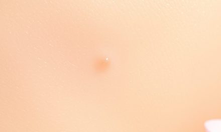 Wysyp po retinolu: jak działa, dla kogo i jak używać